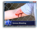 EMR - Bleeding - DVD or USB